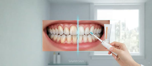 Comparaison avant-après d'une dentition présentant une récession gingivale à gauche et des gencives saines à droite,
