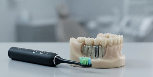 Brosse à dents électrique sonique noire posée à côté d'un modèle anatomique de mâchoire montrant un implant dentaire intégré dans l'os.
