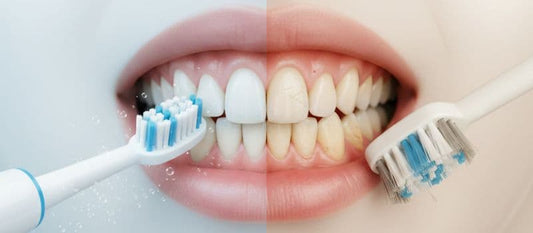 Image comparative montrant deux types de brossage : à gauche, une brosse à dents sonique douce sur un sourire sain ; à droite, une brosse abîmant l'émail et provoquant une gencive rétractée sur des dents jaunies.